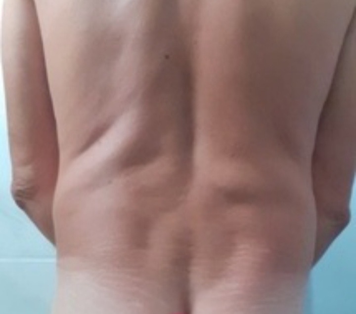 Profil de Sabin